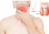 XÉT NGHIỆM CALCITONIN - DẤU ẤN UNG THƯ BIỂU MÔ TUYẾN GIÁP THỂ TỦY